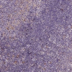 Immunohistochemical staining of human tonsil shows low expression as expected.