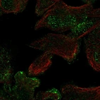 Immunofluorescent staining of human cell line RH-30 shows localization to nucleus & plasma membrane.