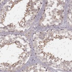Anti-FAM13B Antibody