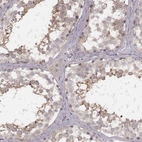 Anti-FAM13B Antibody