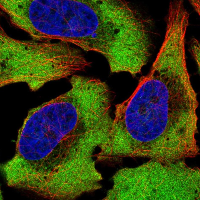 Anti-ATXN2L Antibody