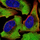 Anti-ATXN2L Antibody