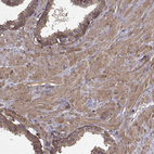 Immunohistochemical staining of human prostate shows weak to moderate cytoplasmic positivity in glandular and smooth muscle cells.