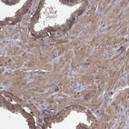 Immunohistochemical staining of human prostate shows weak to moderate cytoplasmic positivity in glandular and smooth muscle cells.