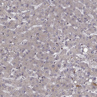 Immunohistochemical staining of human liver shows low positivity in hepatocytes as expected.