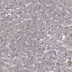 Immunohistochemical staining of human liver shows low positivity in hepatocytes as expected.