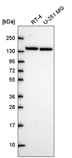 Western blot analysis in human cell line RT-4 and human cell line U-251 MG.