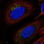 Anti-ITM2B Antibody