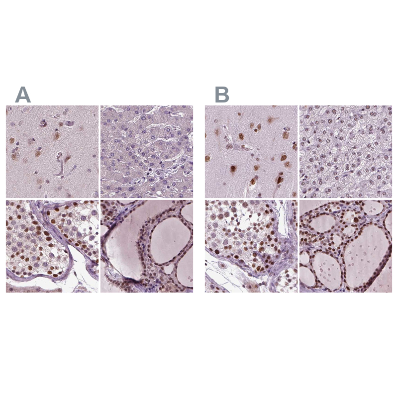 Anti-RCOR3 Antibody