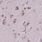Immunohistochemical staining of human cerebral cortex using Anti-RCOR3 antibody HPA071997.