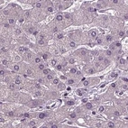 Immunohistochemical staining of human liver using Anti-RCOR3 antibody HPA071997.