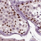 Immunohistochemical staining of human testis using Anti-RCOR3 antibody HPA071997.