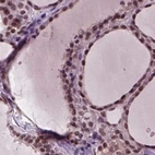 Immunohistochemical staining of human thyroid gland using Anti-RCOR3 antibody HPA071997.