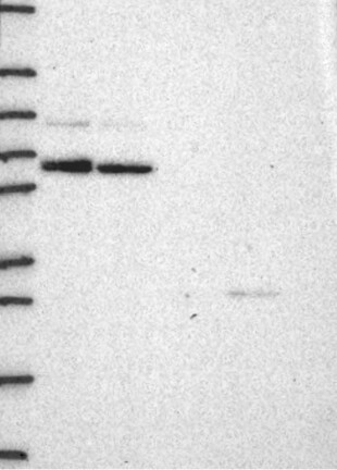 Anti-CCNT1 Antibody