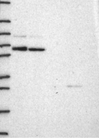 Anti-CCNT1 Antibody