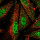Immunofluorescent staining of human cell line SiHa shows localization to nucleoplasm.