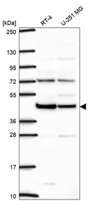 Anti-ILF2 Antibody