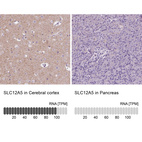 Anti-SLC12A5 Antibody