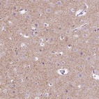 Immunohistochemical staining of human cerebral cortex shows high expression.