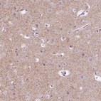 Anti-SLC12A5 Antibody