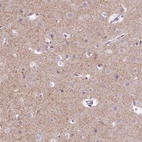 Immunohistochemical staining of human cerebral cortex shows high expression.