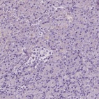 Immunohistochemical staining of human pancreas shows low expression as expected.