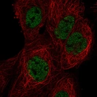 Immunofluorescent staining of human cell line A-431 shows localization to nucleoplasm.
