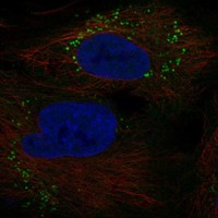 Anti-GOLGA6A Antibody