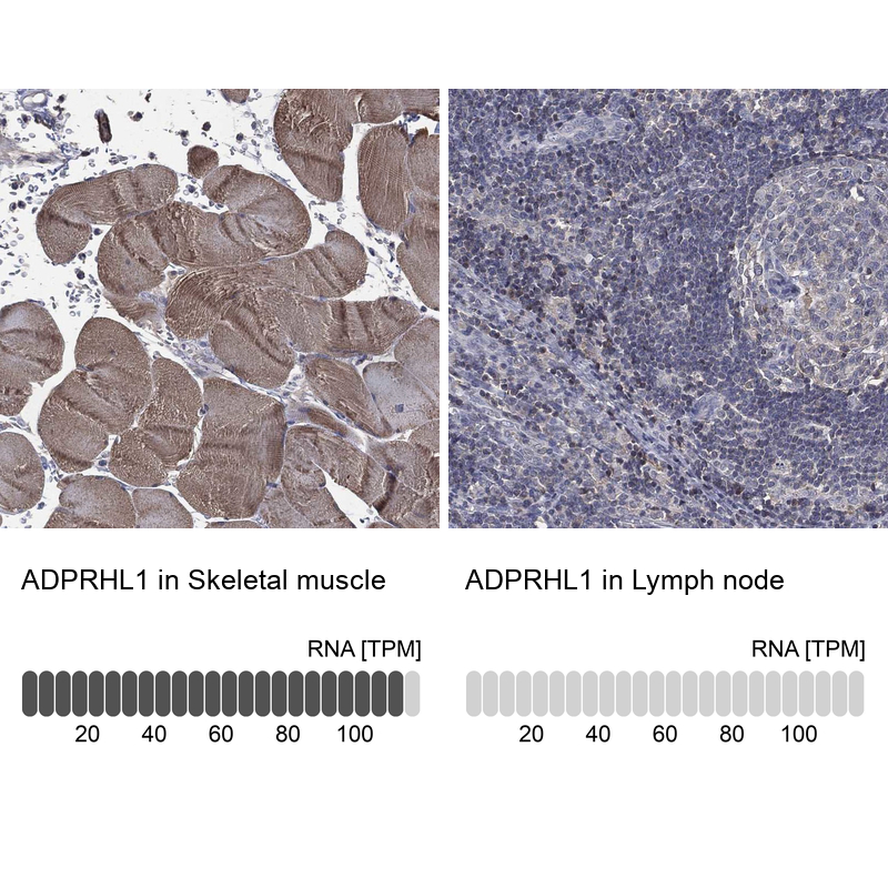 Anti-ADPRHL1 Antibody
