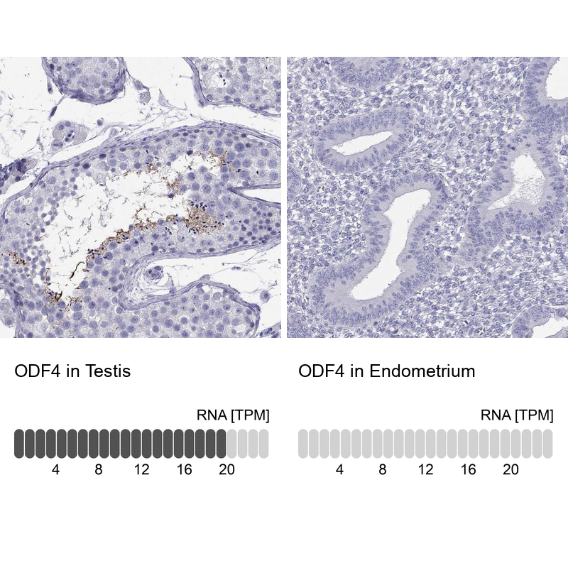 Anti-ODF4 Antibody