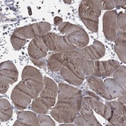 Immunohistochemical staining of human skeletal muscle shows high expression.