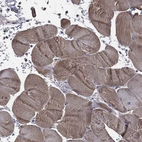 Immunohistochemical staining of human skeletal muscle shows high expression.