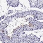 Immunohistochemical staining of human testis shows high expression.