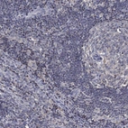 Immunohistochemical staining of human lymph node shows low expression as expected.