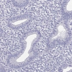 Immunohistochemical staining of human endometrium shows low expression as expected.