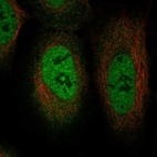 Anti-TRIM49D1 Antibody