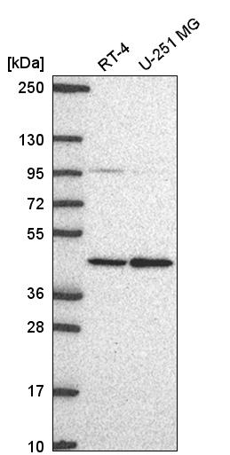 Anti-PRMT1 Antibody