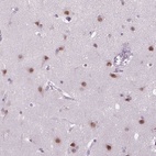 Anti-MAGEB3 Antibody