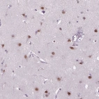 Anti-MAGEB3 Antibody