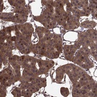 Anti-FBXW11 Antibody
