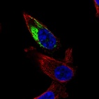 Immunofluorescent staining of human cell line PC-3 shows localization to mitochondria.