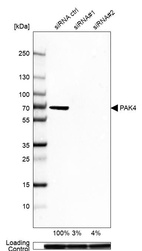 Anti-PAK4 Antibody