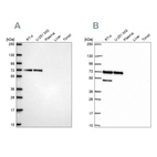 Western blot analysis using Anti-PAK4 antibody HPA072220 (A) shows similar pattern to independent antibody HPA070175 (B).
