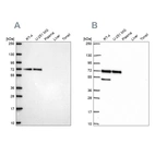 Western blot analysis using Anti-PAK4 antibody HPA072220 (A) shows similar pattern to independent antibody HPA070175 (B).