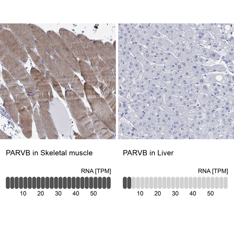 Rabbit Polyclonal Anti-PARVB Antibody - Buy for research - Highly ...