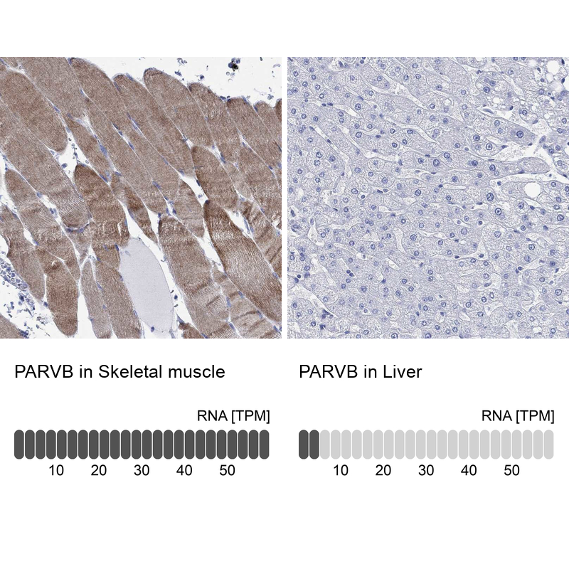 Anti-PARVB Antibody