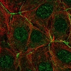 Immunofluorescent staining of human cell line MCF7 shows localization to nucleoplasm, plasma membrane & cell junctions.