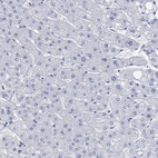 Immunohistochemical staining of human liver shows low expression as expected.