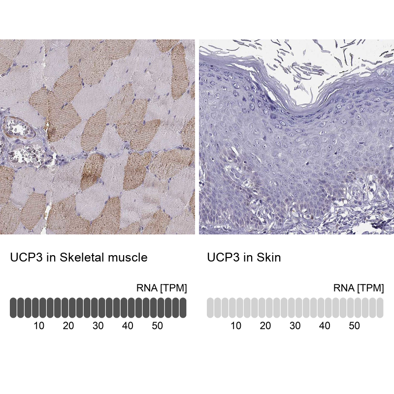 Anti-UCP3 Antibody
