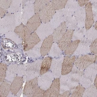 Immunohistochemical staining of human skeletal muscle shows high expression.